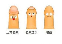 包皮过长