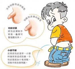 什么是包皮过长和包茎