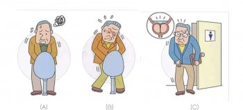 尿频繁是什么原因