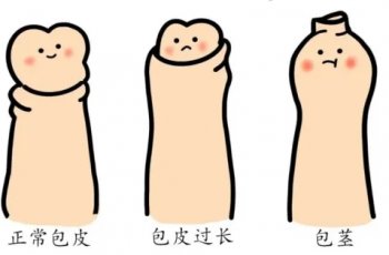 上海割包皮的好处有哪些